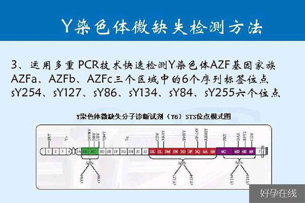 Y染色体微缺失检查