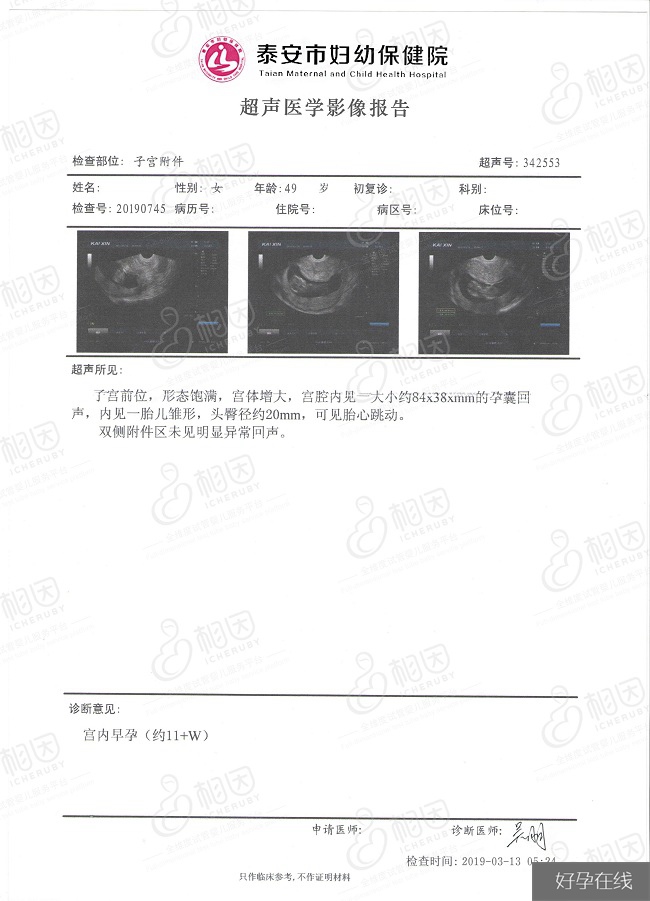 49岁H姐的孕期检查报告