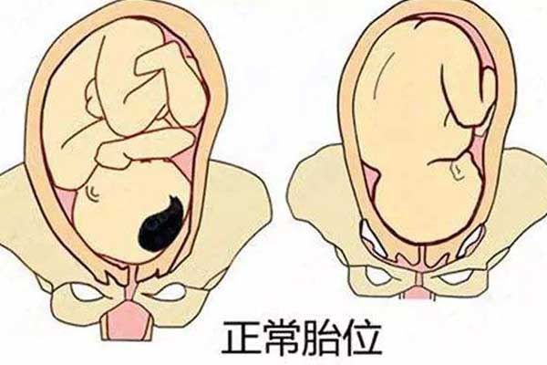 胎方位检查