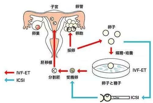 试管婴儿流程平面图