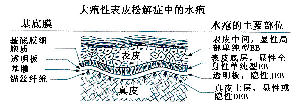 大疱性表皮松解症图片