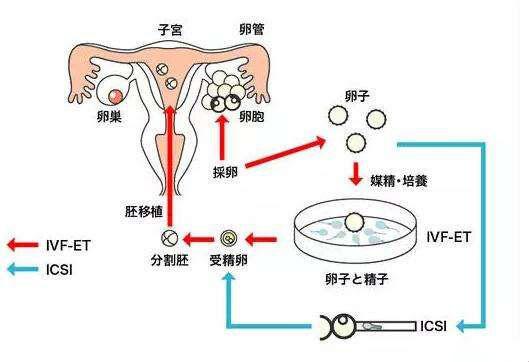 胚胎移植流程图