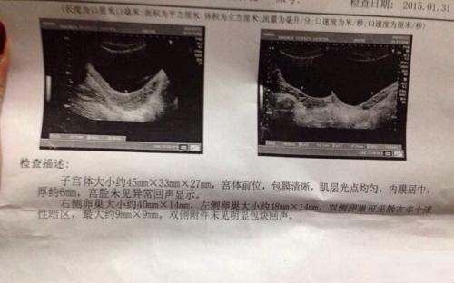 吃达英35有副作用怎么办