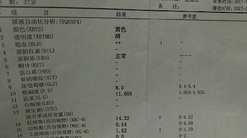 试管降调针检查报告