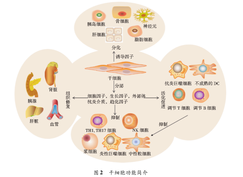 干细胞治疗糖尿病