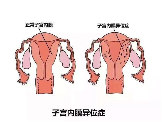 干细胞治疗